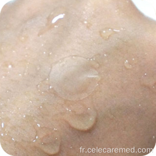 Acné pimple patch hydrocolloïde acné spot sticks